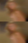 Alexandria disease naked girls