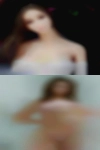 Alexandria disease naked girls