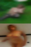 Alexandria disease naked girls
